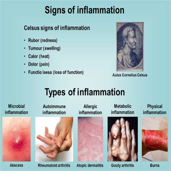Inflammation - Image 2